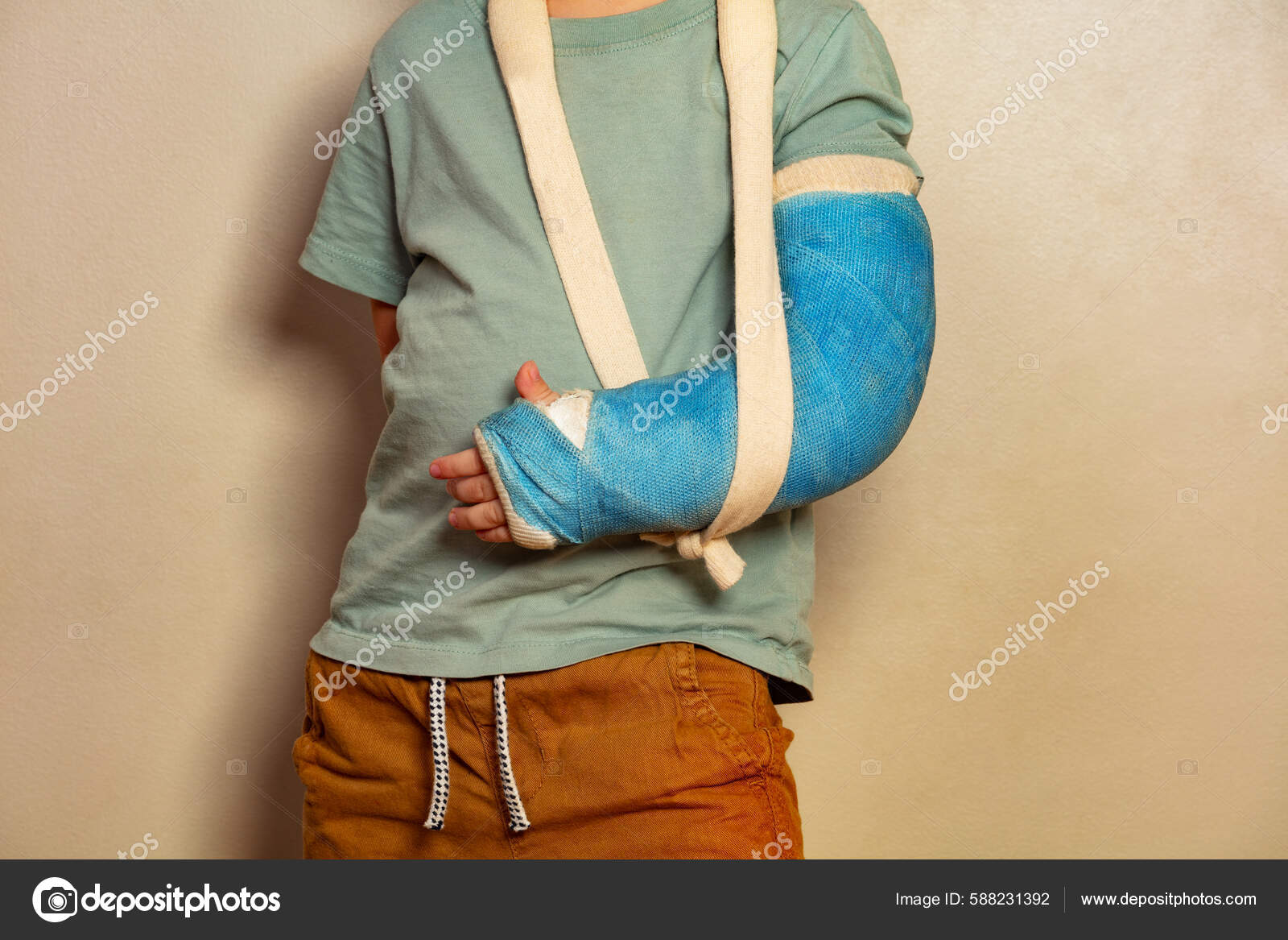 Close Broken Hand Cast Little Boy Standing Wall Stock Photo by ©serrnovik  588231392
